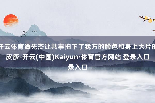 开云体育谭先杰让共事拍下了我方的脸色和身上大片的皮疹-开云(中国)Kaiyun·体育官方网站 登录入口